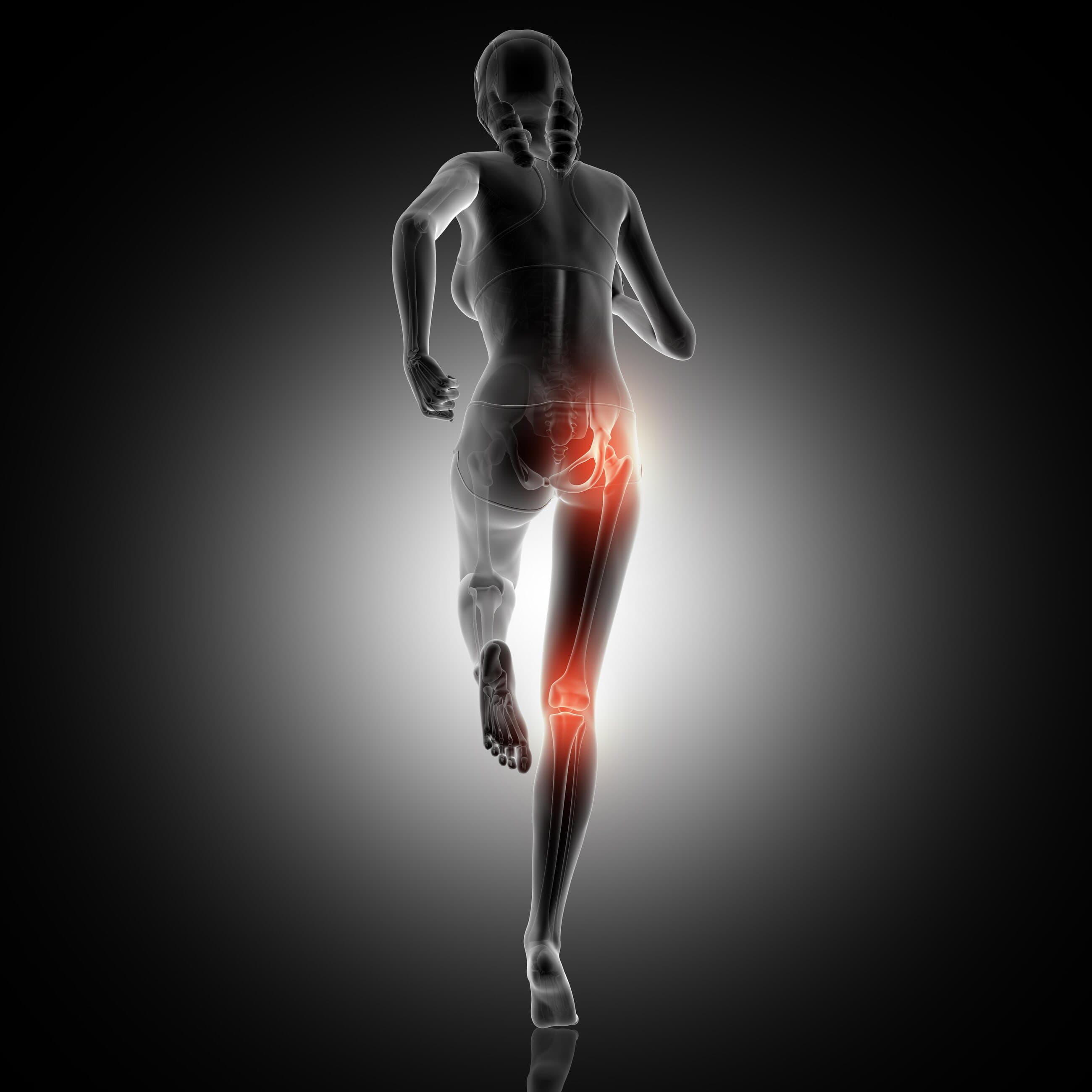 3D anatomical figure mid-stride with the knee joint highlighted